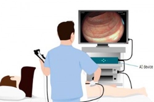 生6个月「废功」20%癌症检出率！pg模拟器试玩柳叶刀惊曝：AI让医(图8)